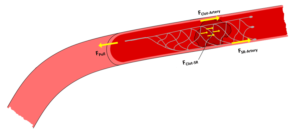 Fig. 1. Free body diagram of the forces present during stent-retriever mechanical thrombectomy..
